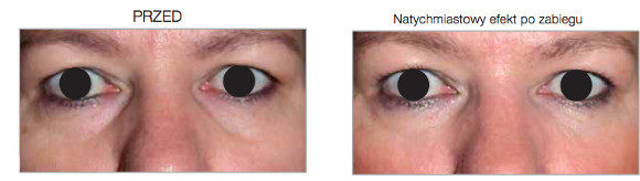 Korekta doliny łez  <?echo $add_image;?>