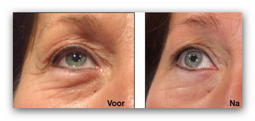 Działanie koktajlu Light Eyes Ultra <?echo $add_image;?>