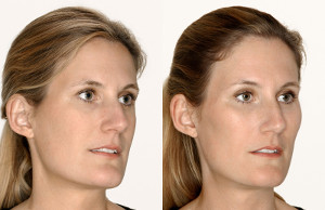 Efekt wolumetrii(2).  <?echo $add_image;?>